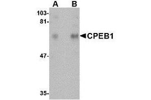 Western blot analysis of CPEB1 in rat brain tissue lysate with AP30241PU-N CPEB1 antibody at (A) 1 and (B) 2 μg/ml. (CPEB1 Antikörper  (N-Term))