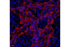 Immunofluorescence of paraffin embedded human colon using LRP (ABIN7074548) at dilution of 1: 250 (400x lens) (MVP Antikörper)