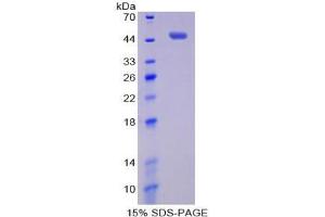 SDS-PAGE analysis of Human Pim-1 Oncogene Protein. (PIM1 Protein)