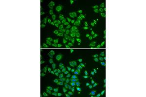 Immunofluorescence analysis of HeLa cells using SMAD1 antibody. (SMAD1 Antikörper)