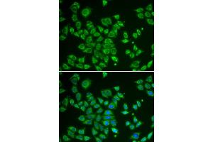 Immunofluorescence analysis of HeLa cells using SMAD1 antibody. (SMAD1 Antikörper)