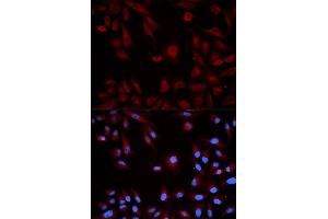 Immunofluorescence analysis of HeLa cell using STAT5B antibody. (STAT5B Antikörper  (AA 40-280))
