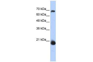 CHCHD4 antibody used at 1 ug/ml to detect target protein. (CHCHD4 Antikörper  (N-Term))