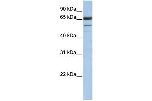 WB Suggested Anti-SEPN1 Antibody Titration:  1 ug/ml  Positive Control:  Hela cell lysate (SEPN1 Antikörper  (C-Term))