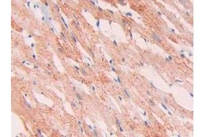 Detection of Slit1 in Rat Heart Tissue using Polyclonal Antibody to Slit Homolog 1 (Slit1)