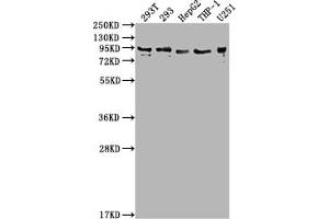 Western Blot Positive WB detected in: 293T whole cell lysate, 293 whole cell lysate, HepG2 whole cell lysate, THP-1 whole cell lysate, U251 whole cell lysate All lanes: CCHCR1 antibody at 1:2000 Secondary Goat polyclonal to rabbit IgG at 1/50000 dilution Predicted band size: 89, 100, 96 kDa Observed band size: 89 kDa (CCHCR1 Antikörper  (AA 281-500))