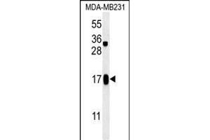 C4orf34 Antibody (C-term) (ABIN651629 and ABIN2840335) western blot analysis in MDA-M cell line lysates (35 μg/lane). (SMIM14 Antikörper  (C-Term))