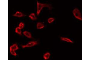 ABIN6266793 staining Hela by IF/ICC. (C1orf57 Antikörper  (C-Term))