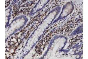 Immunoperoxidase of monoclonal antibody to AKR1B1 on formalin-fixed paraffin-embedded human small Intestine. (AKR1B1 Antikörper  (AA 1-316))