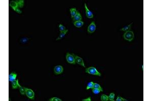 Immunofluorescence (IF) image for anti-Lymphoid Enhancer-Binding Factor 1 (LEF1) (AA 75-216) antibody (ABIN7158656)