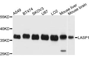 Western blot analysis of extracts of various cell lines, using LASP1 antibody (ABIN5972117) at 1/1000 dilution. (LASP1 Antikörper)
