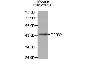 Western Blotting (WB) image for anti-Pyrimidinergic Receptor P2Y, G-Protein Coupled, 4 (P2RY4) (AA 286-365) antibody (ABIN3017282) (P2RY4 Antikörper  (AA 286-365))