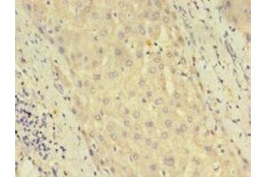 Immunohistochemistry of paraffin-embedded human liver tissue using ABIN7150765 at dilution of 1:100 (DUSP26 Antikörper  (AA 1-211))