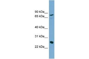 WB Suggested Anti-KLK5 Antibody Titration:  0. (Kallikrein 5 Antikörper  (N-Term))