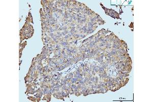 IHC analysis of Neurofibromin/NF1 using anti-Neurofibromin/NF1 antibody (ABIN7600197). (Neurofibromin 1 Antikörper  (AA 160-270))