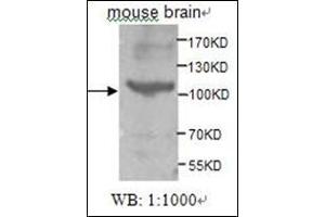 Western Blotting (WB) image for anti-tyrosine Kinase, Non-Receptor, 2 (TNK2) (AA 278-289) antibody (ABIN955283) (TNK2 Antikörper  (AA 278-289))
