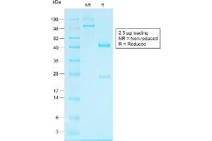 SDS-PAGE Analysis of Purified Glypican-3 Rabbit Recombinant Monoclonal Antibody (GPC3/1534R). (Glypican 3 Antikörper)