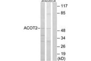 Western Blotting (WB) image for anti-Acyl-CoA Thioesterase 2 (ACOT2) (AA 171-220) antibody (ABIN2890093) (ACOT2 Antikörper  (AA 171-220))