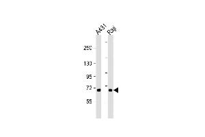 All lanes : Anti-P3K5 Antibody  at 1:2000 dilution Lane 1: A431 whole cell lysate Lane 2: Raji whole cell lysate Lysates/proteins at 20 μg per lane. (ASK1 Antikörper  (AA 821-849))