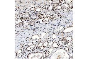 IHC analysis of SNRNP200 using anti-SNRNP200 antibody (ABIN7602032). (SNRNP200 Antikörper  (AA 557-2129))