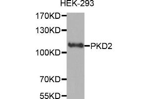 Western Blotting (WB) image for anti-Polycystic Kidney Disease 2 (Autosomal Dominant) (PKD2) antibody (ABIN1874147) (PKD2 Antikörper)