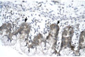 Human Stomach; IVNS1ABP antibody - N-terminal region in Human Stomach cells using Immunohistochemistry (IVNS1ABP Antikörper  (N-Term))