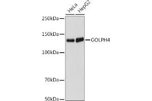 Western blot analysis of extracts of various cell lines, using GOLPH4 antibody (ABIN7267488) at 1:1000 dilution. (Golgi Integral Membrane Protein 4 (GOLIM4) Antikörper)