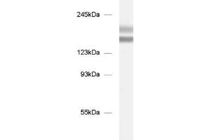 dilution: 1 : 1000, sample: mouse brain homogenate (Tenascin R Antikörper)