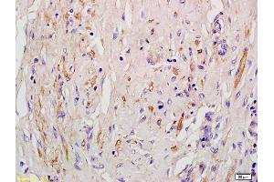 Immunohistochemistry (IHC) image for anti-Angiotensin II Receptor, Type 1 (AGTR1) antibody (ABIN671121)
