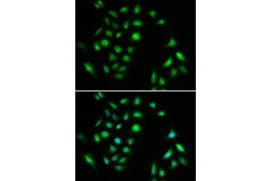 Immunofluorescence (IF) image for anti-conserved Helix-Loop-Helix Ubiquitous Kinase (CHUK) (C-Term) antibody (ABIN3022825)