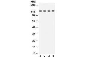 Western blot testing of human 1) HeLa, 2) Jurkat, 3) SKOV and 4) mouse kidney lysate with SLC12A1 antibody.