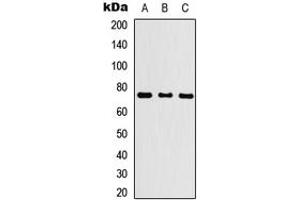 Western blot analysis of KLHL29 expression in HEK293T (A), NS-1 (B), PC12 (C) whole cell lysates. (KLHL29 Antikörper  (Center))