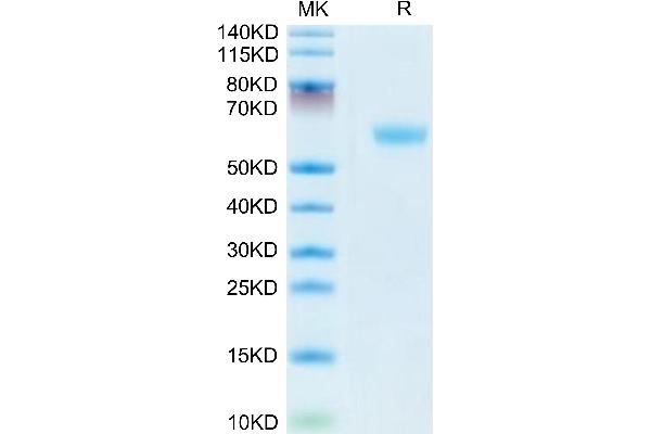 CD160 Protein (CD160) (AA 28-160) (Fc Tag)
