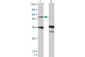 Western Blot analysis of MMP13 expression in transfected 293T cell line by MMP13 monoclonal antibody (M07), clone 3B11.