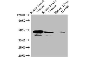 Western blot All lanes: Selenoprotein P antibody at 2 μg/mL + Mouse heart tissue Secondary Goat polyclonal to rabbit IgG at 1/10000 dilution Predicted band size: 43 kDa Observed band size: 43 kDa (Selenoprotein P (SELENOP) (AA 20-381) Antikörper)