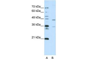 WB Suggested Anti-ZNF488 Antibody Titration:  2. (ZNF488 Antikörper  (C-Term))