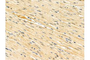 Phospho-HSF1 (Ser121) Antibody at 1/100 staining Rat heart tissue by IHC-P.