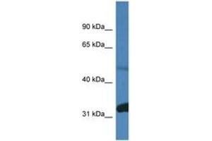 Image no. 1 for anti-Protein Phosphatase 2, Regulatory Subunit B, delta (PPP2R2D) (AA 380-429) antibody (ABIN6746439) (PPP2R2D Antikörper  (AA 380-429))