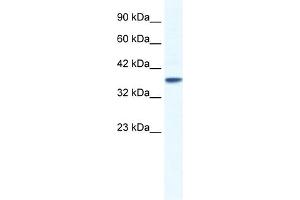WB Suggested Anti-KCNK3 Antibody Titration:  1. (KCNK3 Antikörper  (C-Term))