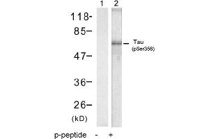 Image no. 1 for anti-Microtubule-Associated Protein tau (MAPT) (pSer356) antibody (ABIN319219) (MAPT Antikörper  (pSer356))