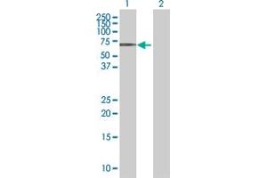 Western Blot analysis of MITF expression in transfected 293T cell line by MITF MaxPab polyclonal antibody. (MITF Antikörper  (AA 1-520))