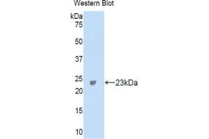 Western blot analysis of the recombinant protein. (CA5A Antikörper  (AA 7-179))