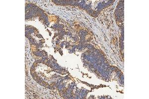 IHC analysis of SEC23IP using anti-SEC23IP antibody (ABIN7601222). (SEC23IP Antikörper  (AA 30-426))