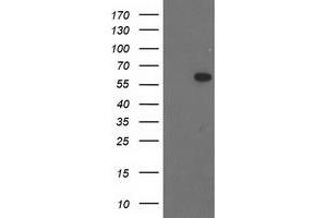 Western Blotting (WB) image for anti-BAI1-Associated Protein 2 (BAIAP2) antibody (ABIN1496807)