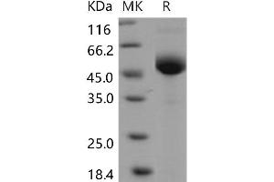 Western Blotting (WB) image for Lymphocyte Antigen 96 (LY96) protein (Fc Tag) (ABIN7320047)