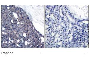 Image no. 1 for anti-Nuclear Factor of kappa Light Polypeptide Gene Enhancer in B-Cells Inhibitor, alpha (NFKBIA) (Tyr42) antibody (ABIN197391) (NFKBIA Antikörper  (Tyr42))