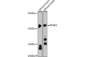 Western blot analysis of extracts of various cell lines, using FF antibody (ABIN6129724, ABIN6140586, ABIN6140587 and ABIN6216341) at 1:3000 dilution. (FFAR3 Antikörper  (AA 257-346))
