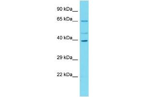 Western Blotting (WB) image for anti-Chromosome 16 Open Reading Frame 59 (C16ORF59) (N-Term) antibody (ABIN2791199) (C16ORF59 Antikörper  (N-Term))