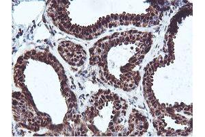 Immunohistochemical staining of paraffin-embedded Human breast tissue using anti-PSMB7 mouse monoclonal antibody. (PSMB7 Antikörper  (AA 58-277))