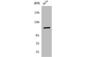Western Blot analysis of HeLa cells using CARD 6 Polyclonal Antibody (CARD6 Antikörper  (N-Term))